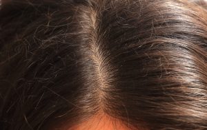 「牛磺酸」及「氨基磺酸」系列的成分：能防止頭皮乾燥