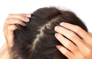 頭皮容易乾燥發癢者，建議可選「海藻萃取」或「植物萃取」配方